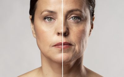 “El Método Secreto para Rejuvenecer 10 Años en Solo Unas Semanas: Descubre el Lifting Facial Moderno”