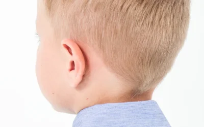 La otoplastia en niños: una decisión de salud que va más allá de la estética