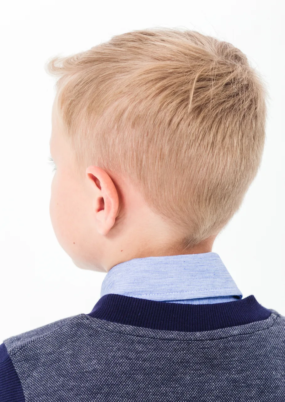 Detalle de la cabeza de un niño rubio de pelo corto visto por detrás, para ilustrar la otoplastia.